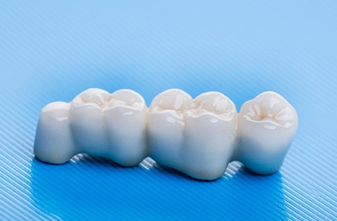 Man smiles at dentist