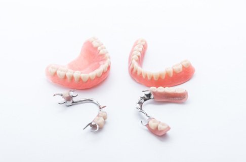 Animated smile with dental implant supported dental crown