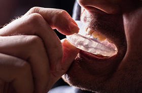 Woman having dental procedure