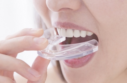 Patient placing mouthguard after oral cancer screening