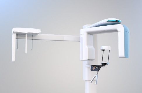 3 D C T cone beam digital x-ray scanner system
